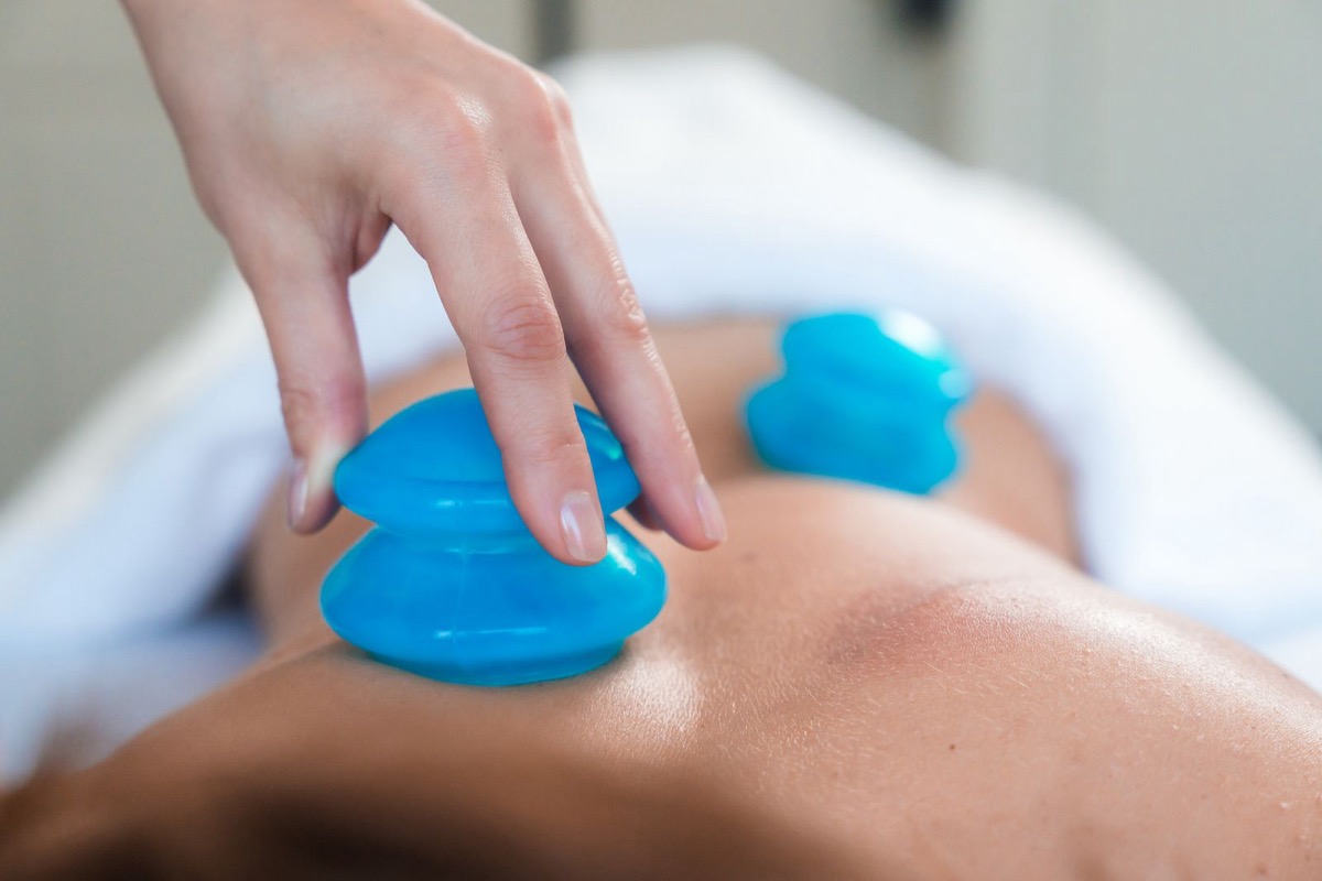 Cupping massage